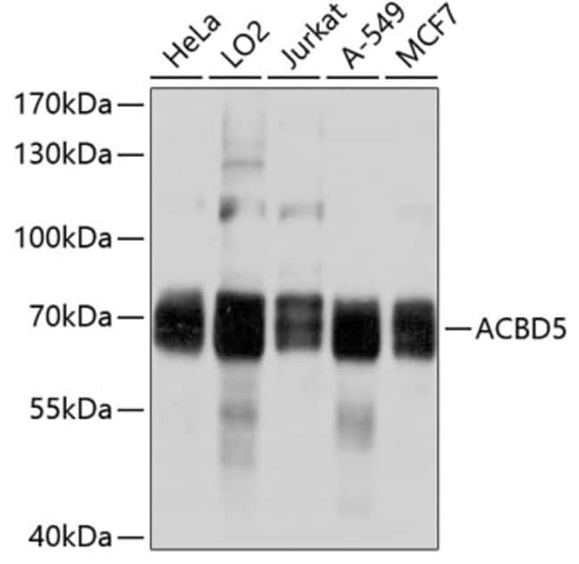 100UL ACBD5 ANTIBODY 100 ul
