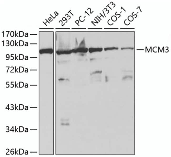 100UL MCM3 ANTIBODY 100 ul