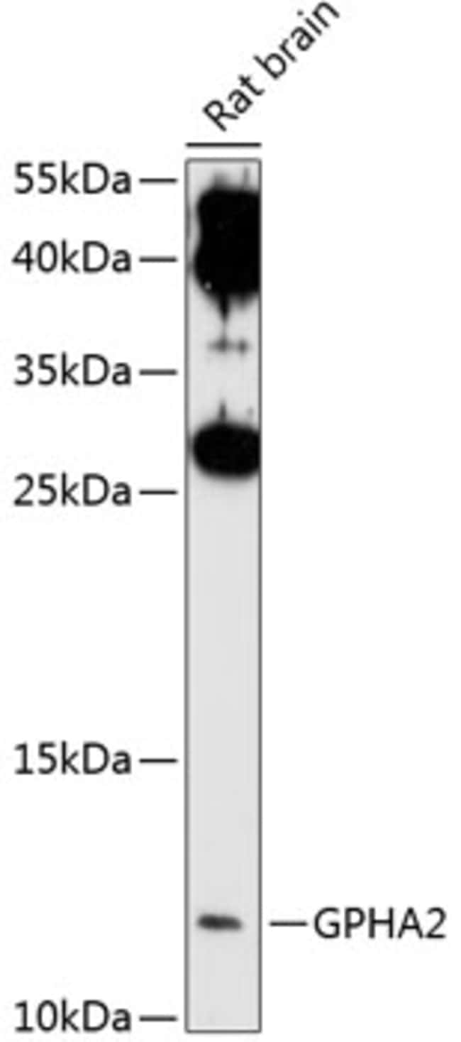 100UL GPHA2 ANTIBODY 100 ul