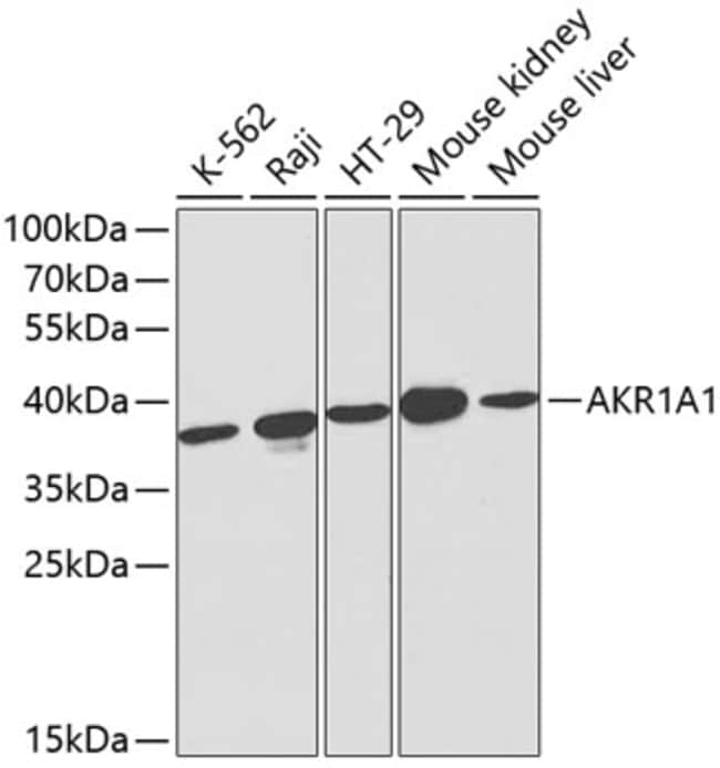 100UL AKR1A1 ANTIBODY 100 ul