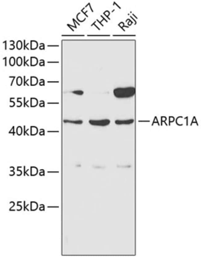 100UL ARPC1A ANTIBODY 100 ul