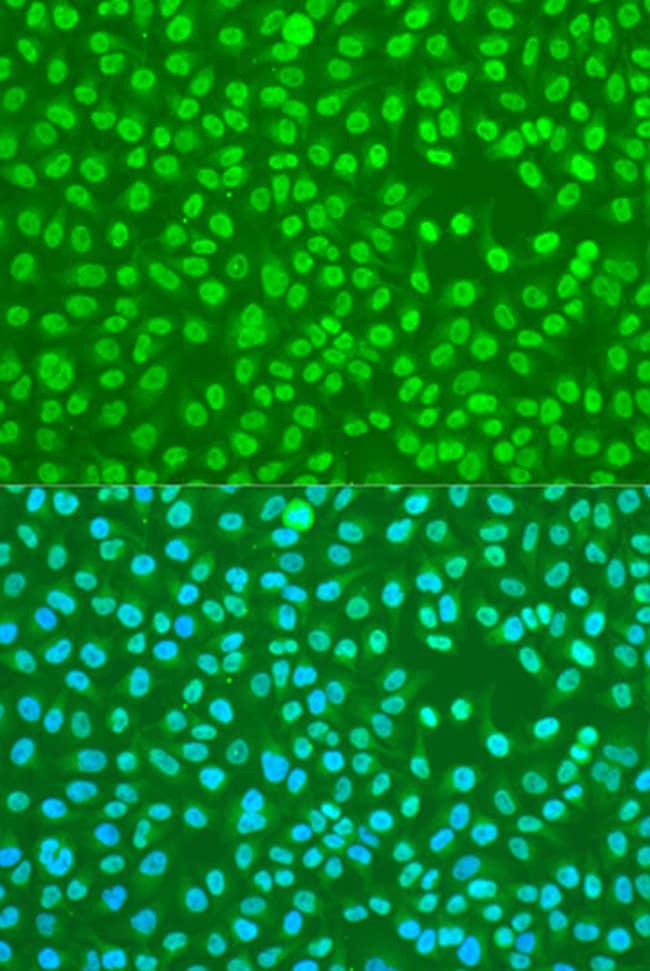 100UL HNRNP DL ANTIBODY 100 ul