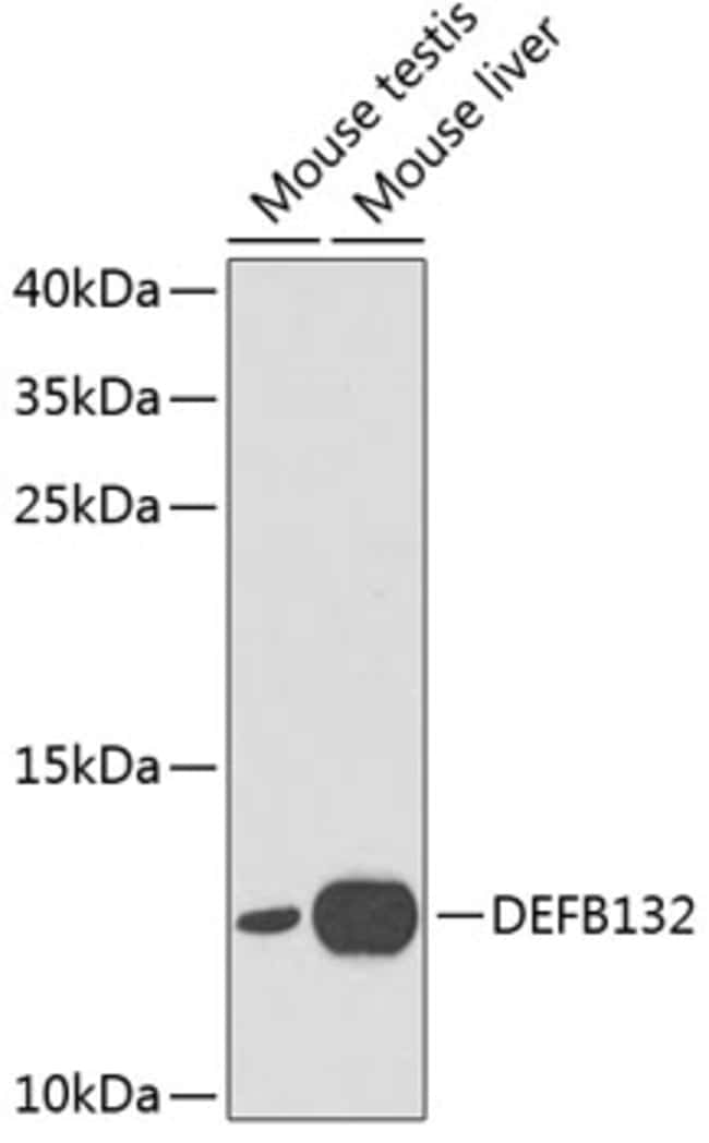 100UL DEFB132 ANTIBODY 100 ul