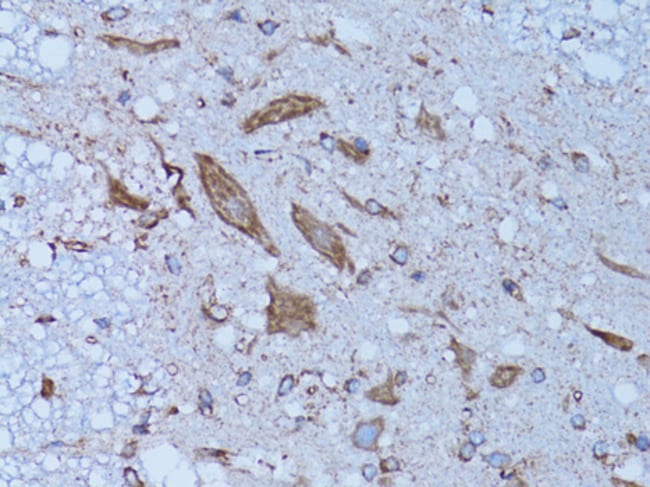 100UL HADH ANTIBODY 100 ul
