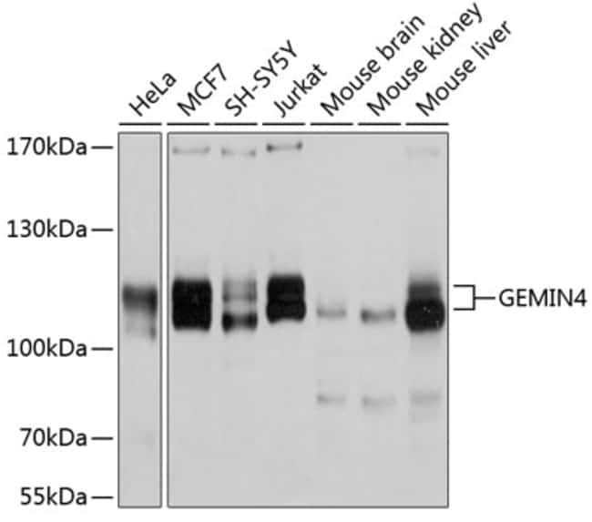 100UL GEMIN 4 ANTIBODY 100 ul