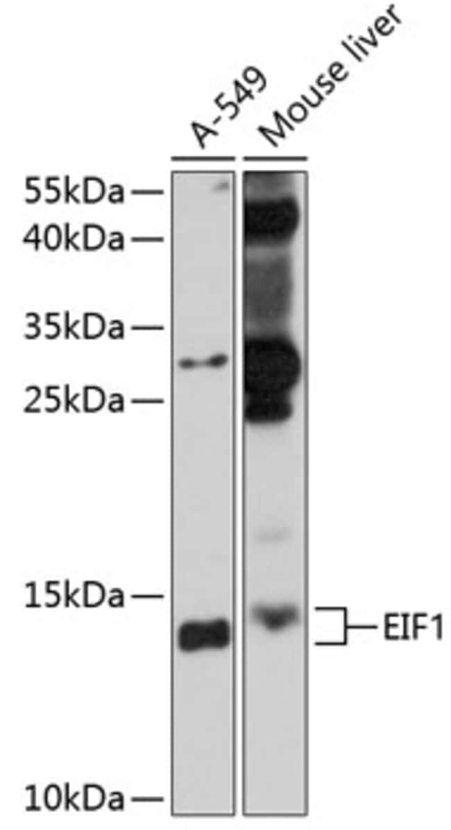 100UL EIF1 ANTIBODY 100 ul