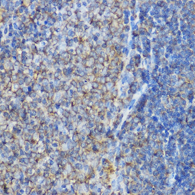 100UL ARPC2 ANTIBODY 100 ul
