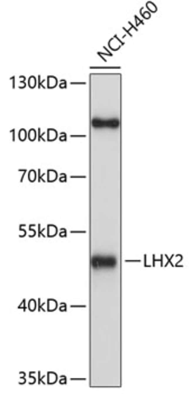 100UL LHX2 ANTIBODY 100 ul