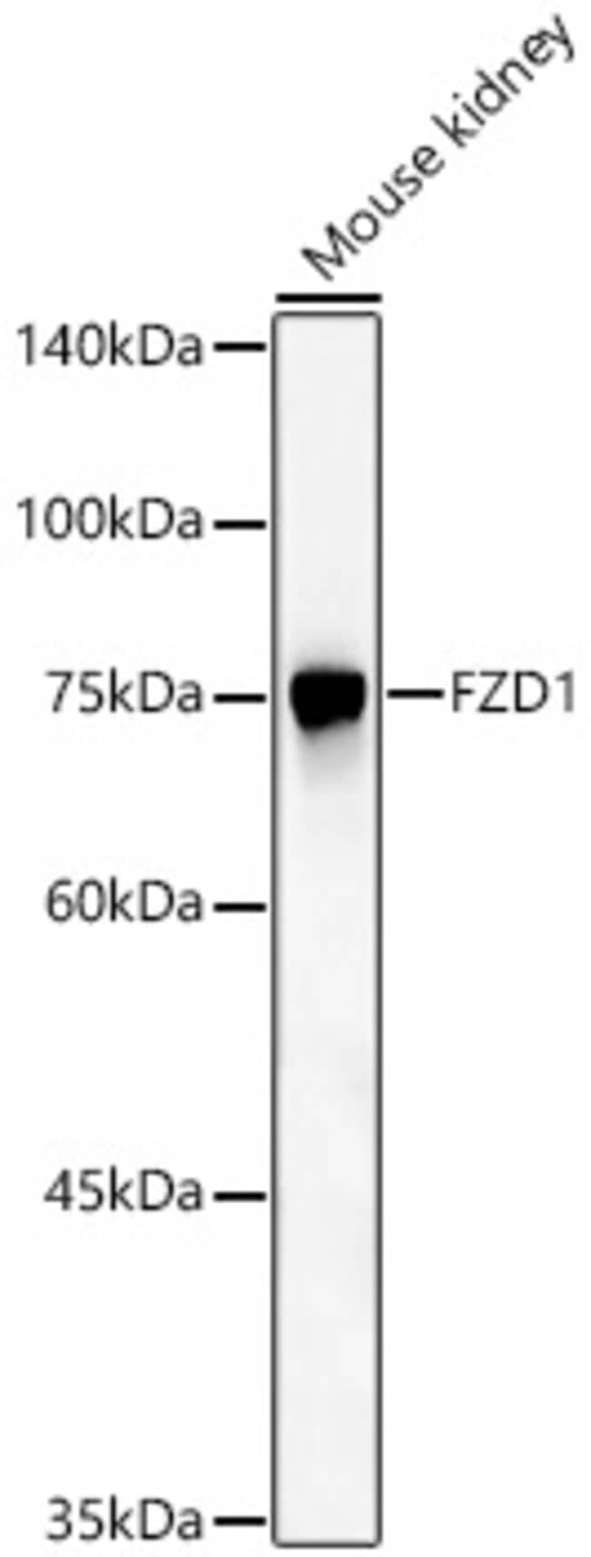 100UL FZD1 ANTIBODY 100 ul
