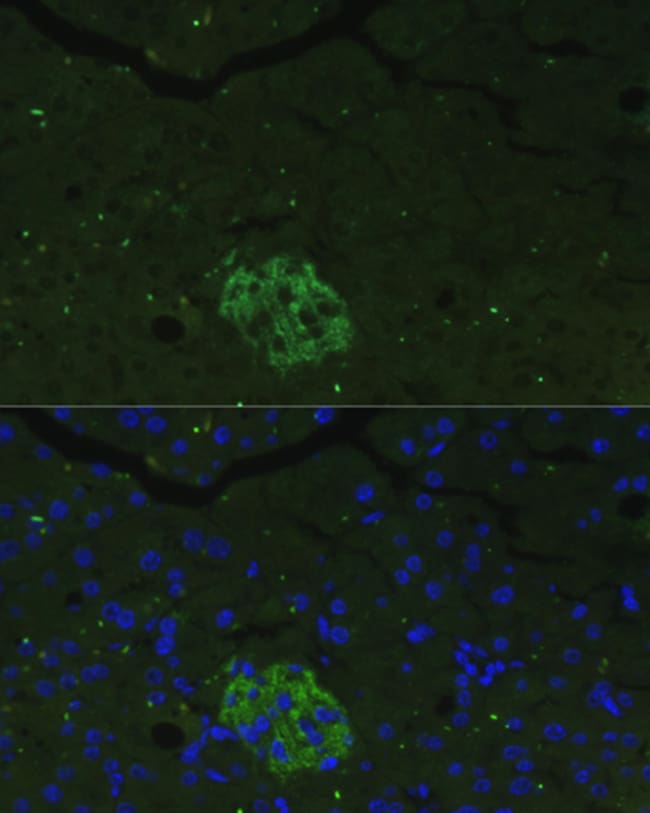 100UL FAM3B ANTIBODY 100 ul