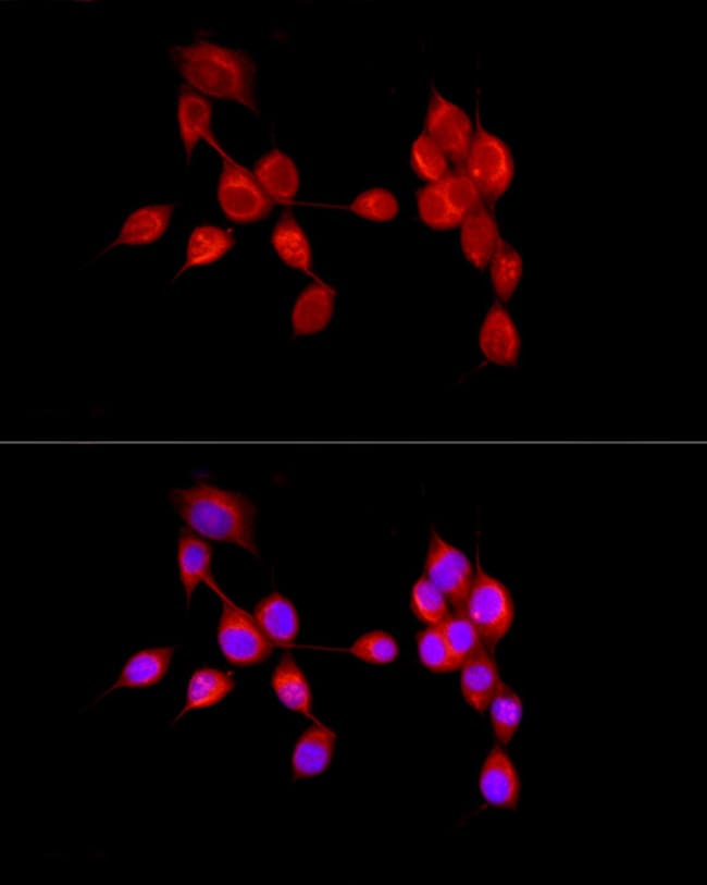 100UL AMBRA1 ANTIBODY 100 ul