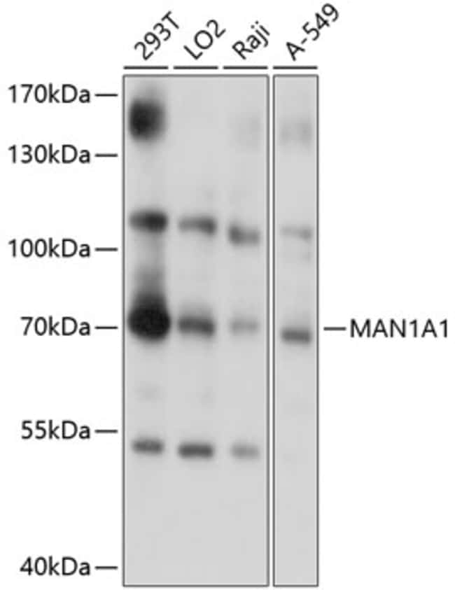 100UL MAN1A1 ANTIBODY 100 ul