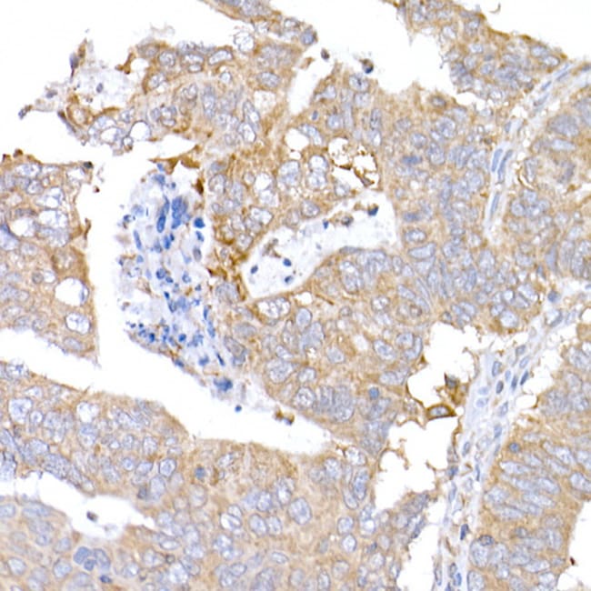 100UL MAGED1 ANTIBODY 100 ul
