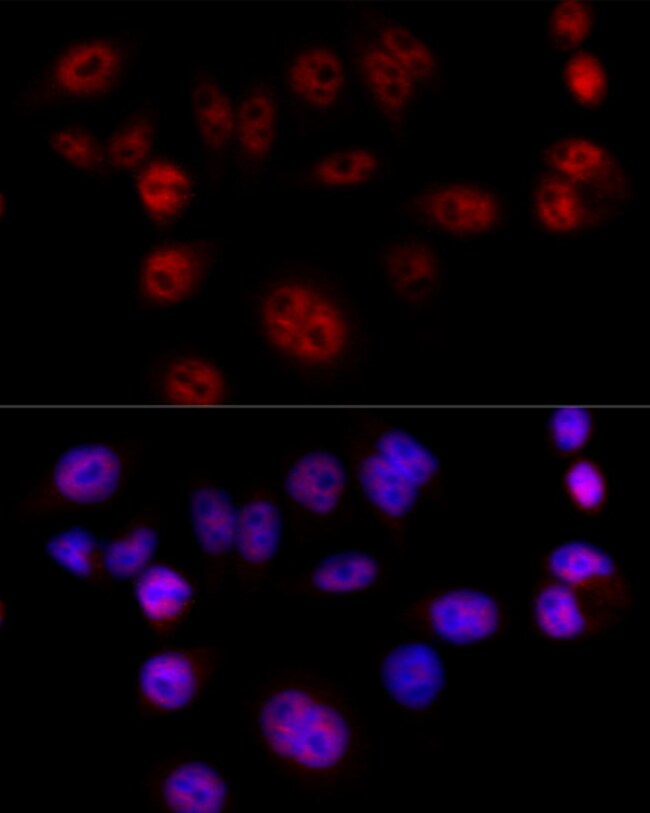 100UL CYCLIN D1 ANTIBODY 100 ul