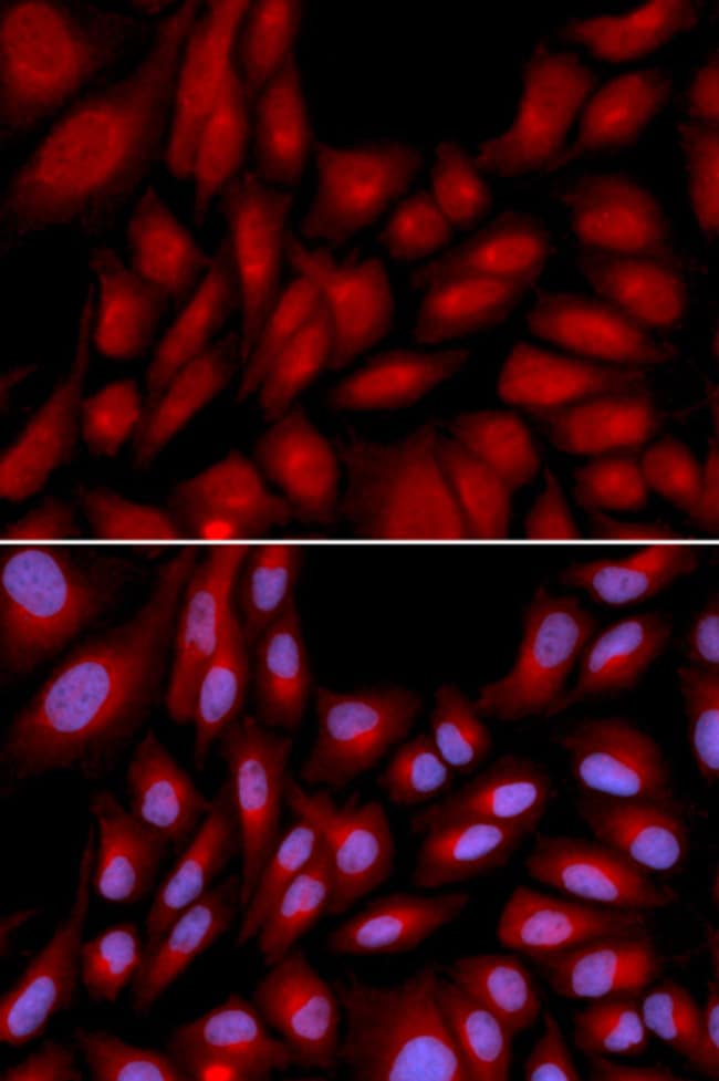 100UL BAG1 ANTIBODY 100 ul