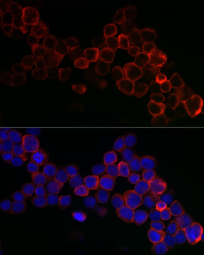 100UL GPX1 ANTIBODY 100 ul