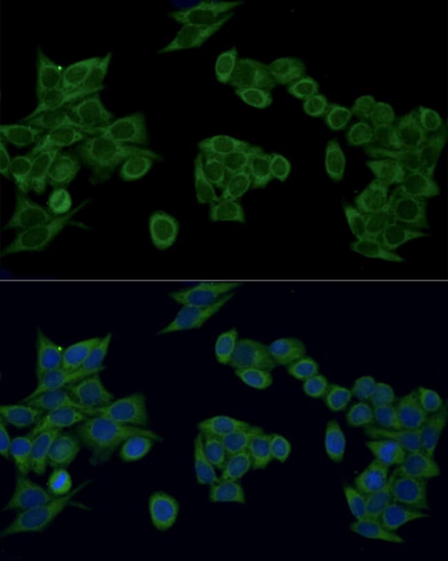 100UL IRF3 ANTIBODY 100 ul
