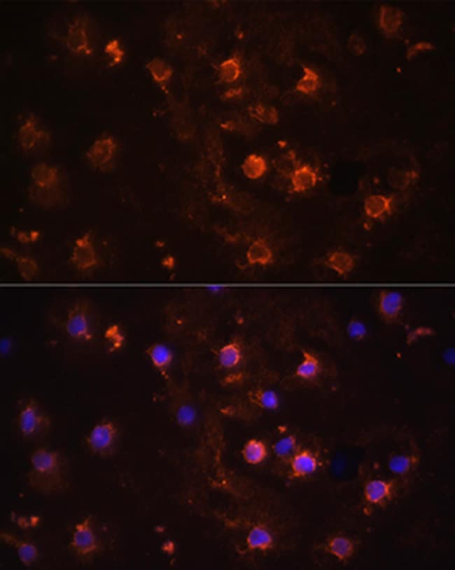 100UL IL-1 BETA ANTIBODY 100 ul