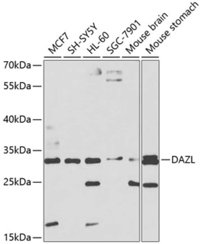 100UL DAZL ANTIBODY 100 ul