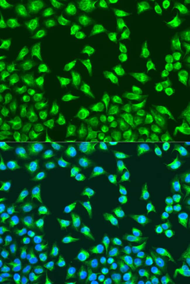 100UL MTCO2 ANTIBODY 100 ul