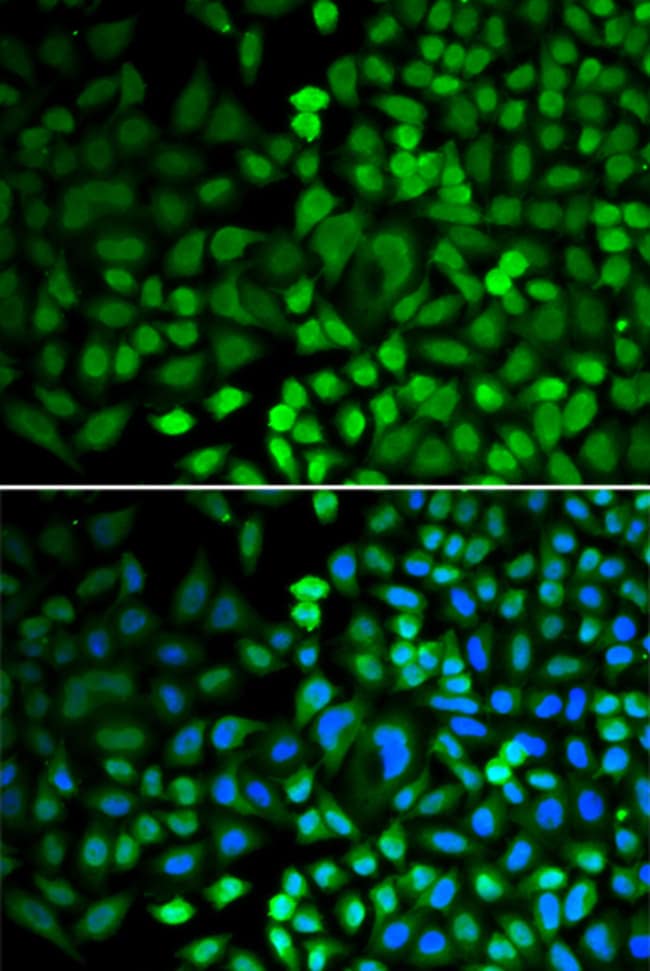 100UL APE1 ANTIBODY 100 ul