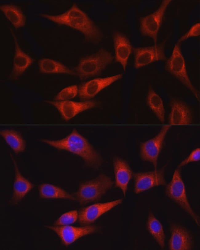 100UL FAK ANTIBODY 100 ul