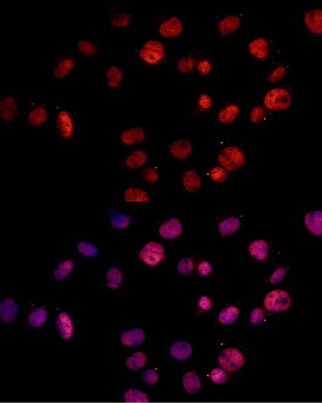 100UL MSH2 ANTIBODY 100 ul