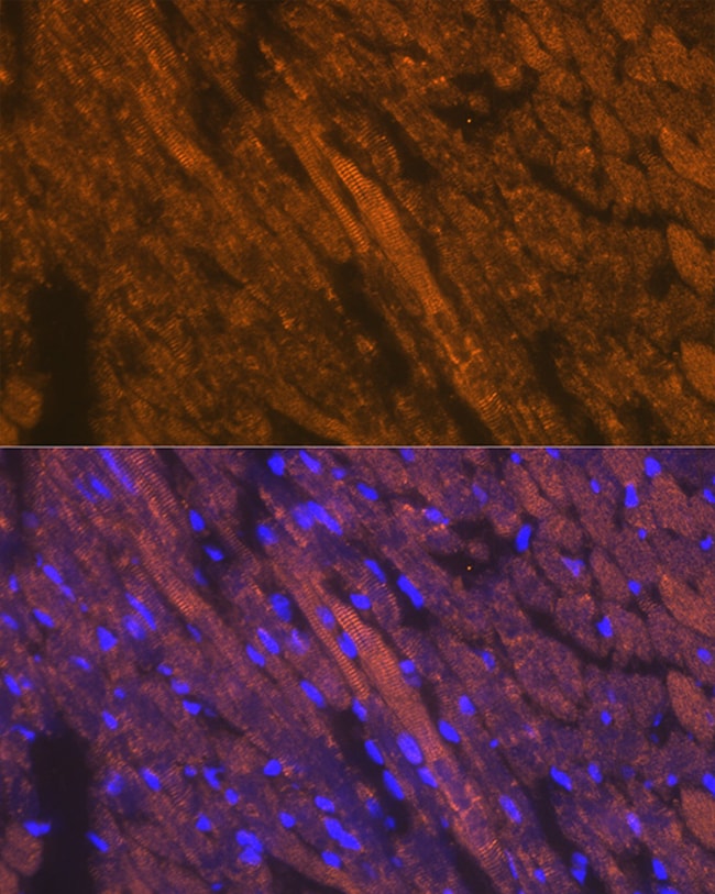 100UL CARDIAC TROPONIN T ANTIBODY 100 ul