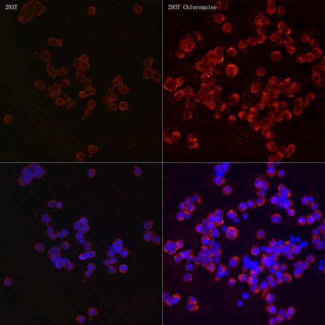 100UL LC3B ANTIBODY 100 ul