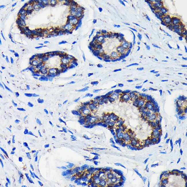 100UL AMACR ANTIBODY 100 ul