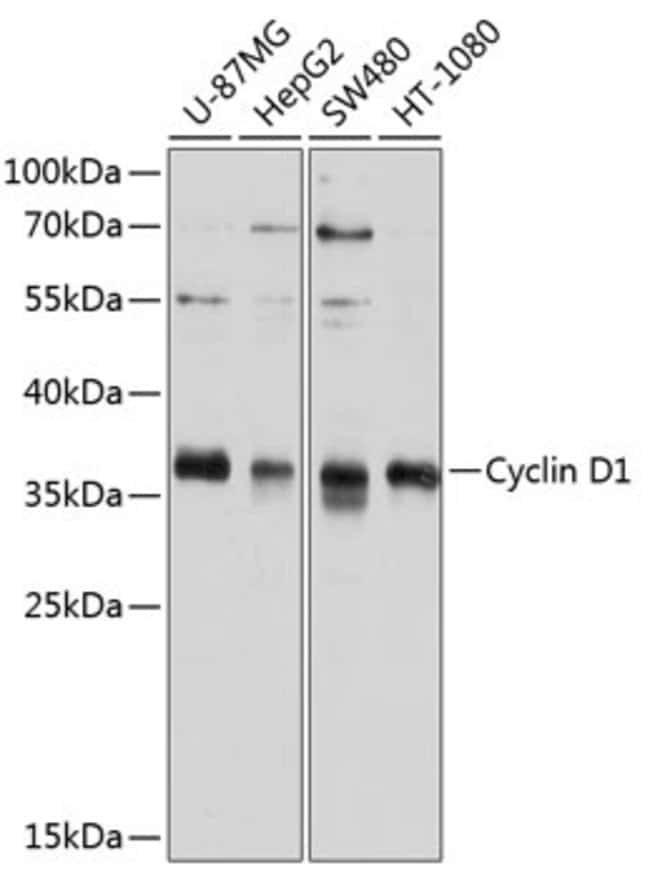 100UL CYCLIN D1 ANTIBODY 100 ul