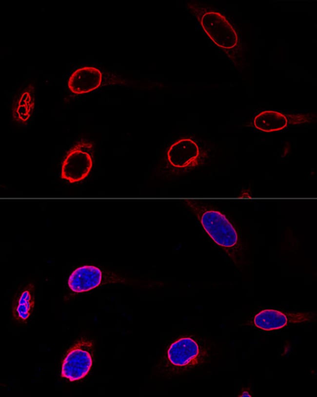 100UL EMERIN ANTIBODY 100 ul
