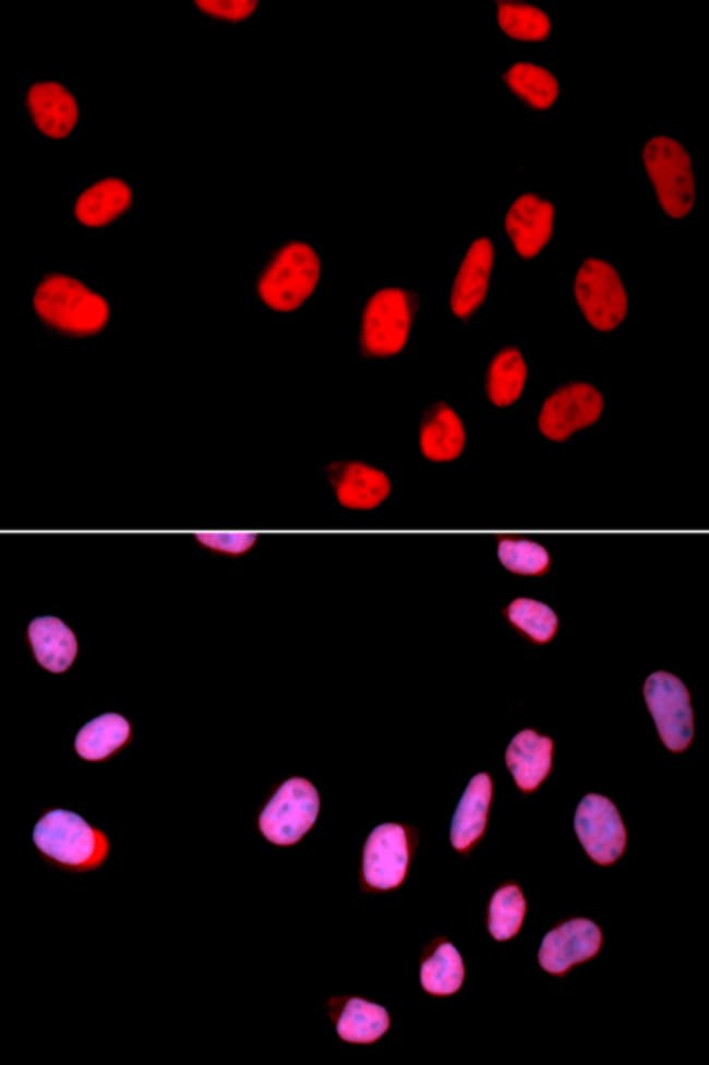 100UL CDC25C ANTIBODY 100 ul