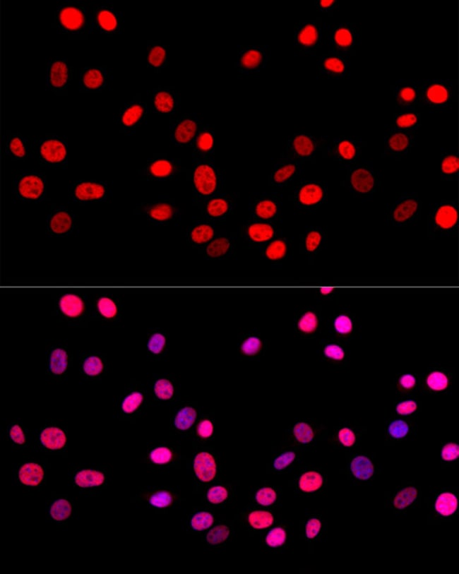100UL C-JUN ANTIBODY 100 ul
