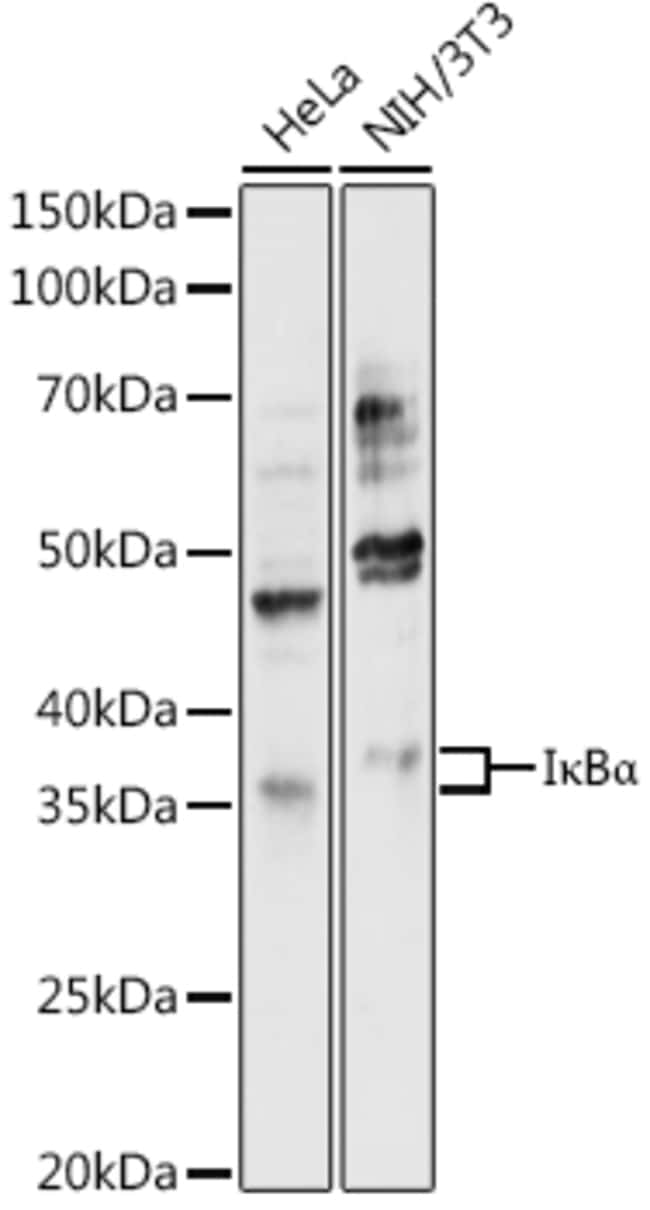 100UL IKB ALPHA ANTIBODY 100 ul