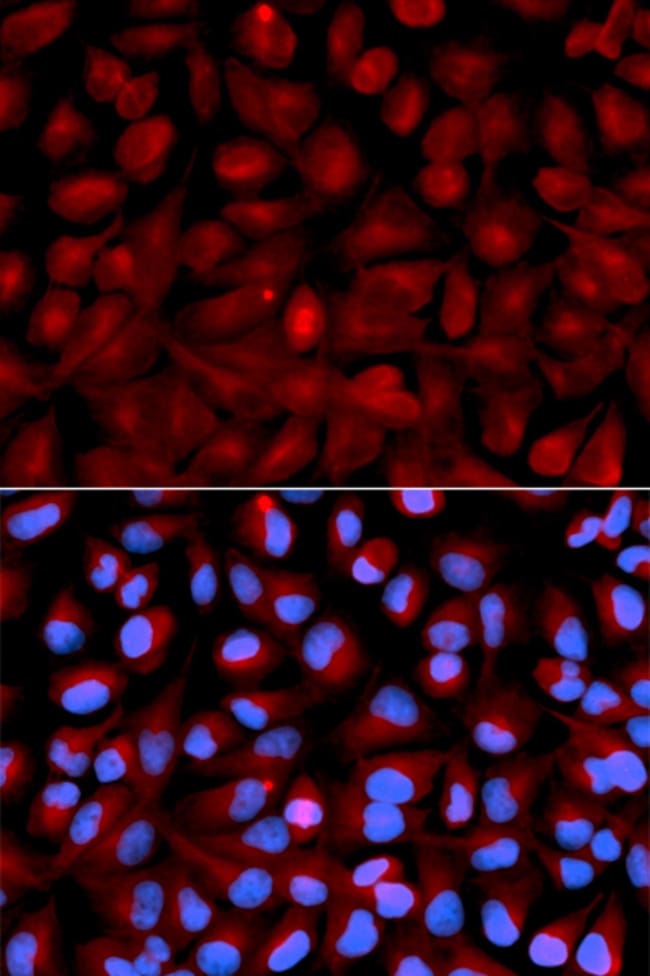 100UL HDAC6 ANTIBODY 100 ul