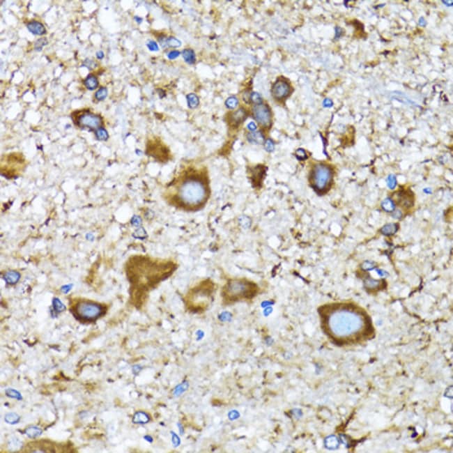 100UL LC3A ANTIBODY 100 ul