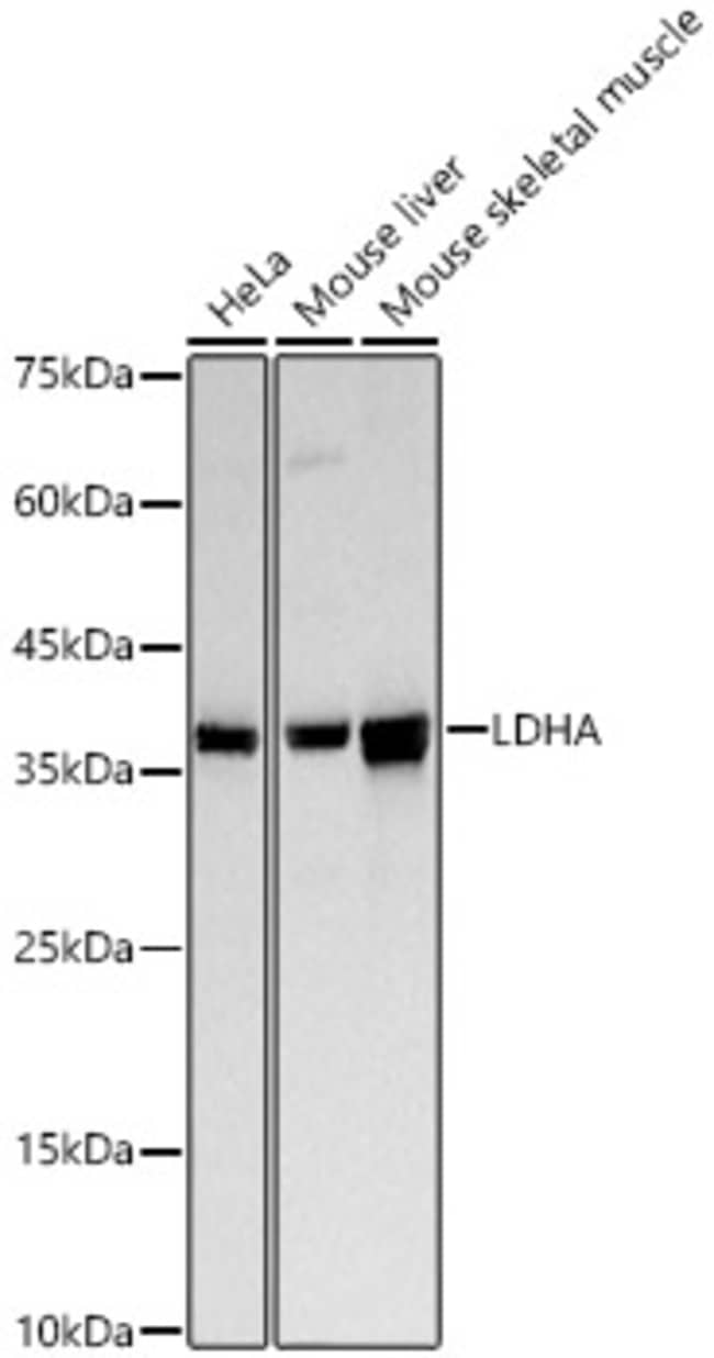 100UL LDHA ANTIBODY 100 ul