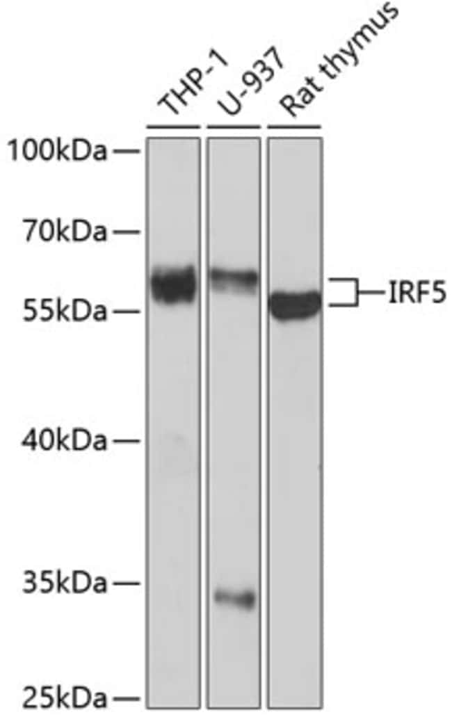 100UL IRF5 ANTIBODY 100 ul