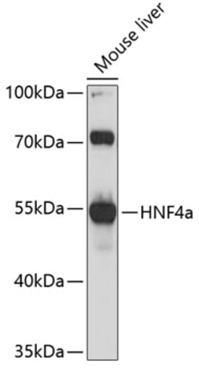 100UL HNF4A ANTIBODY 100 ul
