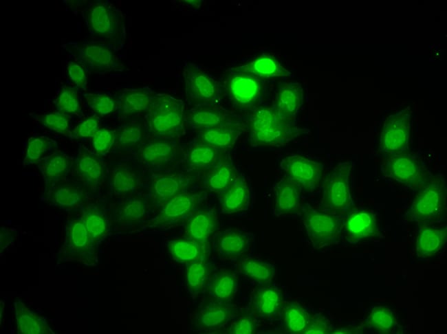 100UL MAD1 ANTIBODY 100 ul