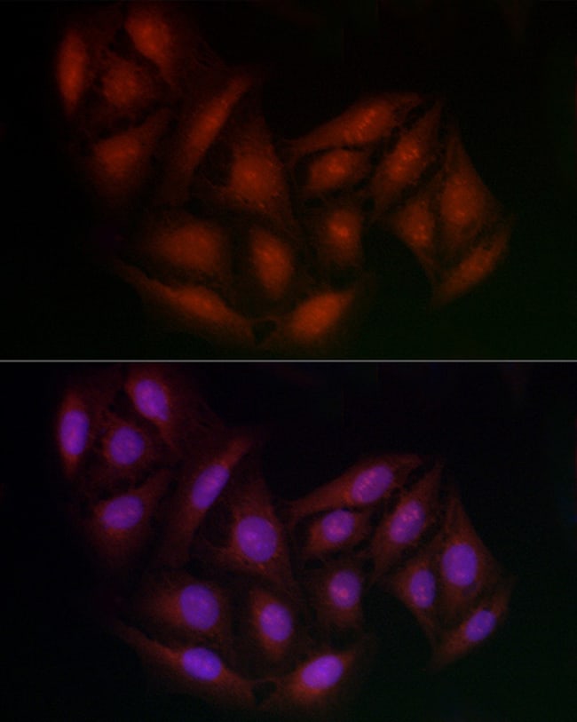 100UL BRCA1 ANTIBODY 100 ul