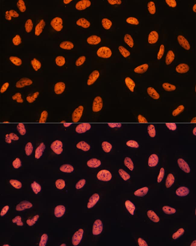 100UL CHD4 ANTIBODY 100 ul