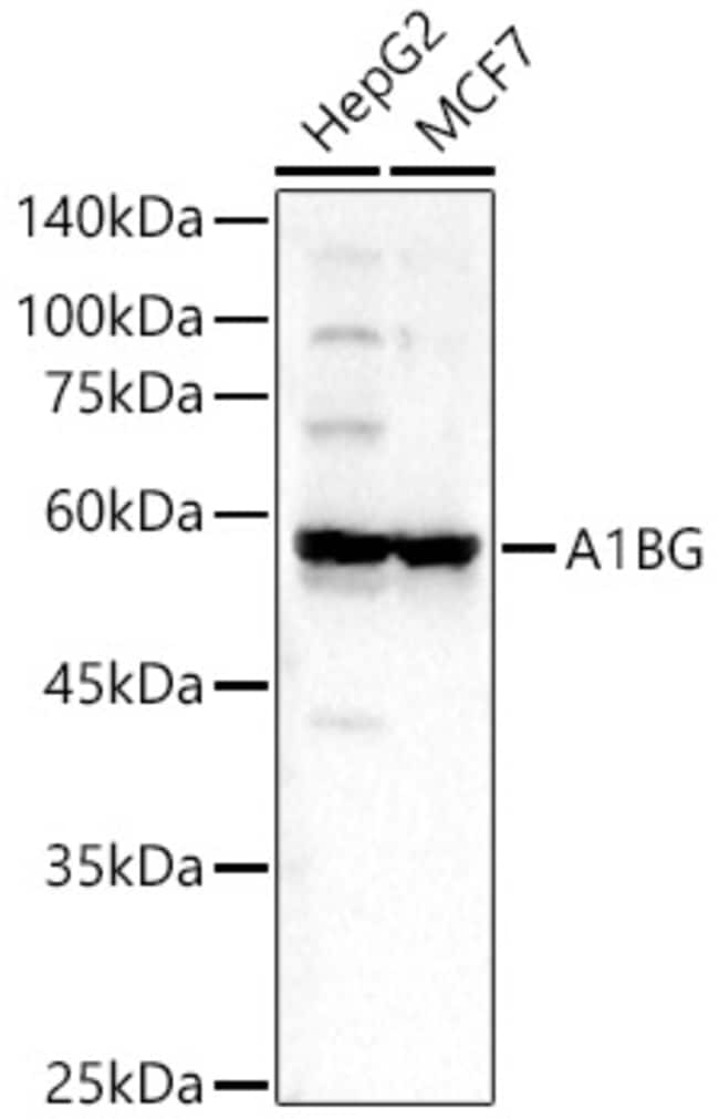 100UL A1BG ANTIBODY 100 ul