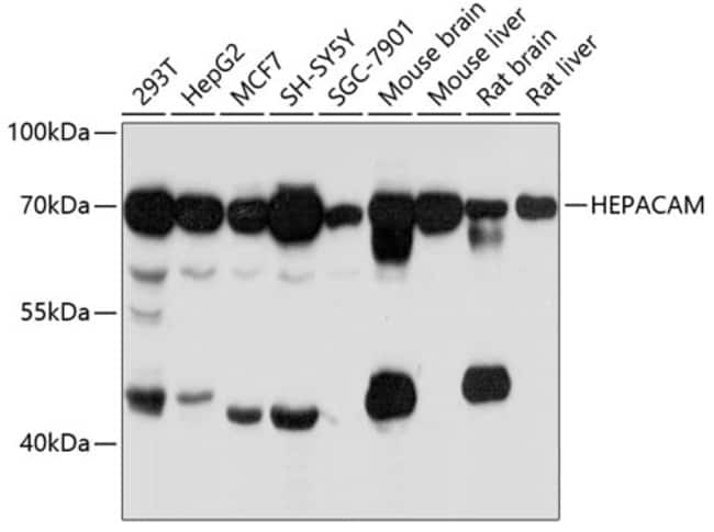 100UL HEPACAM ANTIBODY 100 ul