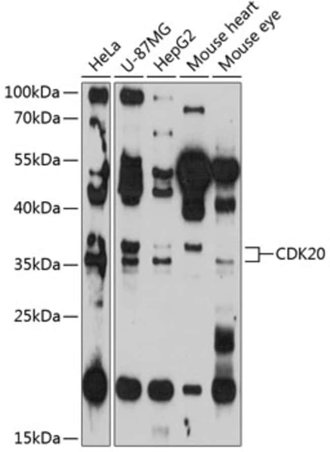 100UL CDK20 ANTIBODY 100 ul