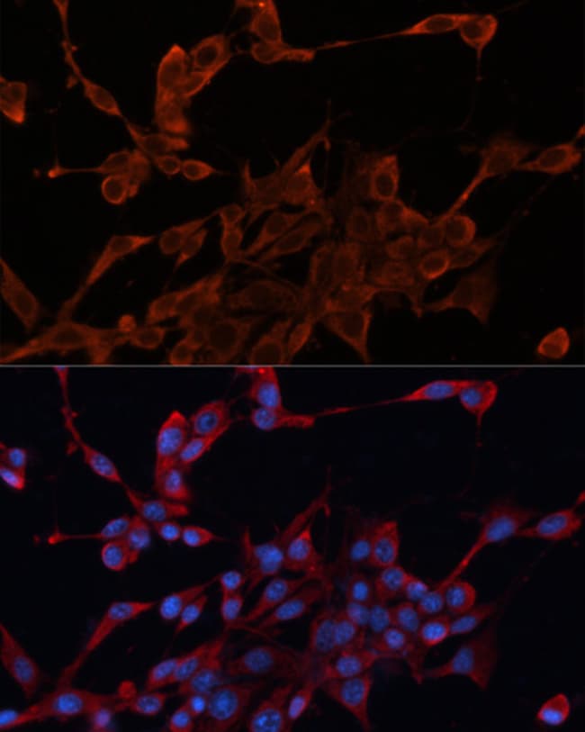 100UL HDJ2 ANTIBODY 100 ul