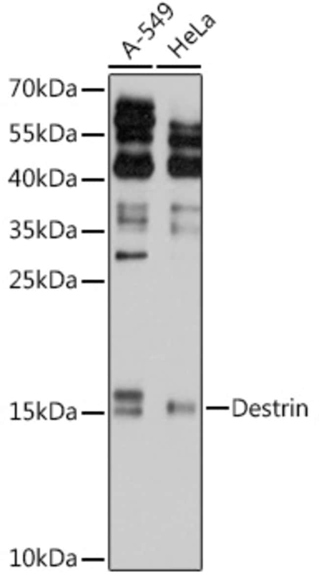 100UL DESTRIN ANTIBODY 100 ul