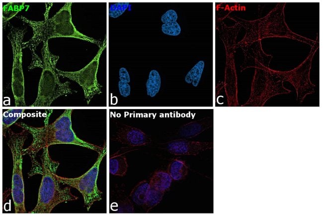 100UL FABP7 ANTIBODY 100 ul