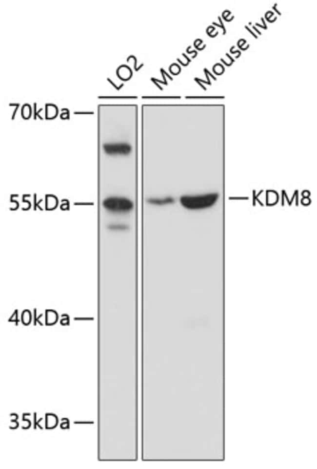 100UL JMJD5 ANTIBODY 100 ul
